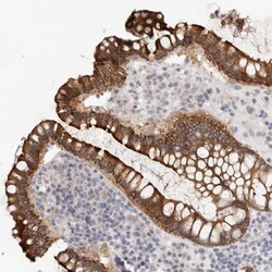 USH1C Antibody, Novus Biologicals:Antibodies:Primary Antibodies