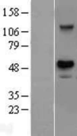 Novus Biologicals™ USH1G Overexpression Lysate
