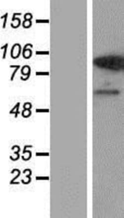 Novus Biologicals&trade;&nbsp;USP1 Overexpression Lysate