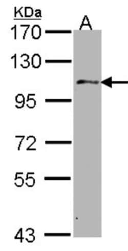 USP10 Antibody, Novus Biologicals 0.1mL; Unlabeled:Antibodies, Polyclonal