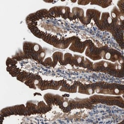 USP10 Antibody, Novus Biologicals:Antibodies:Primary Antibodies