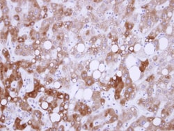 USP14 Antibody, Novus Biologicals 0.1mL; Unlabeled:Antibodies, Polyclonal