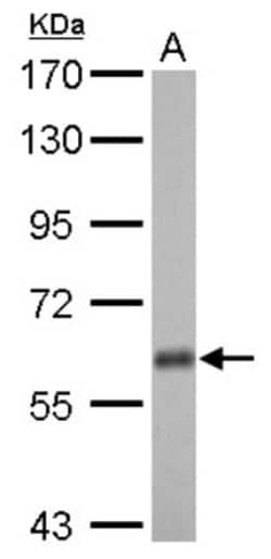 USP14 Antibody, Novus Biologicals 0.1mL; Unlabeled:Antibodies, Polyclonal
