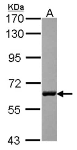 USP14 Antibody, Novus Biologicals 0.1mL; Unlabeled:Antibodies, Polyclonal