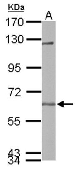 USP14 Antibody, Novus Biologicals 0.1mL; Unlabeled:Antibodies, Polyclonal