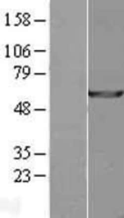 Novus Biologicals™ USP14 Overexpression Lysate