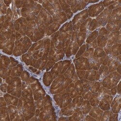 Spectrin beta 2 Antibody, Novus Biologicals:Antibodies:Primary Antibodies