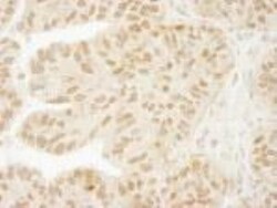 USP15 Antibody, Novus Biologicals 0.1mg; Unlabeled:Antibodies, Polyclonal