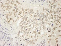 USP15 Antibody, Novus Biologicals 0.1mg; Unlabeled:Antibodies, Polyclonal