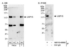 USP15 Antibody, Novus Biologicals 0.1mg; Unlabeled:Antibodies, Polyclonal