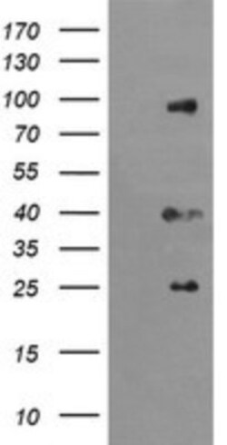 USP16 Antibody (OTI1B4), Novus Biologicals 0.1mL; Unlabeled:Antibodies,