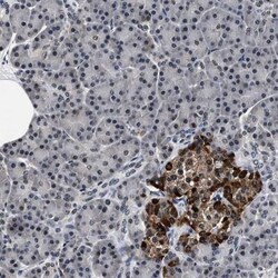 KRBA2 Antibody, Novus Biologicals:Antibodies:Primary Antibodies