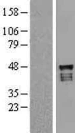 Novus Biologicals&trade;&nbsp;USP2 Overexpression Lysate