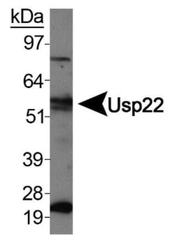 USP22 Antibody - BSA Free, Novus Biologicals:Antibodies:Primary Antibodies
