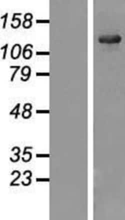 Novus Biologicals&trade;&nbsp;USP25 Overexpression Lysate
