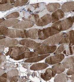USP25 Antibody, Novus Biologicals 0.1mL; Unlabeled:Antibodies, Polyclonal