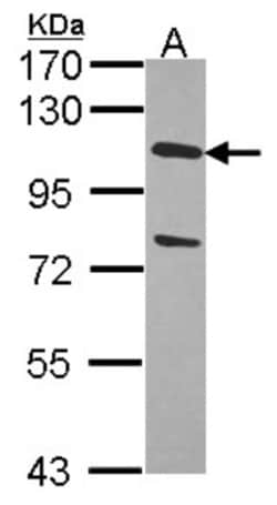 USP28 Antibody, Novus Biologicals 0.1mg; Unlabeled:Antibodies, Polyclonal