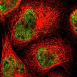 USP28 Antibody, Novus Biologicals 25 &mu;L; Unlabeled:Antibodies, Polyclonal