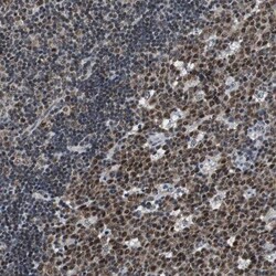 USP28 Antibody, Novus Biologicals:Antibodies:Primary Antibodies