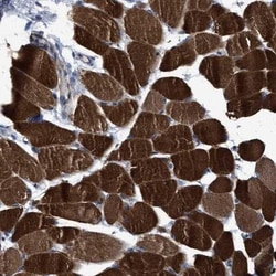 USP29 Antibody, Novus Biologicals 0.1mL; Unlabeled:Antibodies, Polyclonal