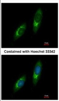 USP33 Antibody, Novus Biologicals 0.1mL; Unlabeled:Antibodies, Polyclonal