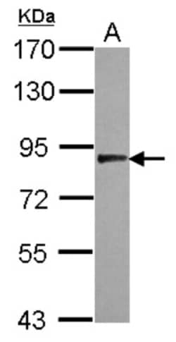 USP33 Antibody, Novus Biologicals 0.1mL; Unlabeled:Antibodies, Polyclonal