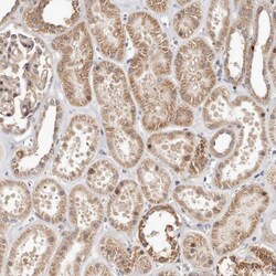 USP33 Antibody, Novus Biologicals 0.1mL; Unlabeled:Antibodies, Polyclonal