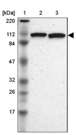 USP33 Antibody, Novus Biologicals 0.1mL; Unlabeled:Antibodies, Polyclonal