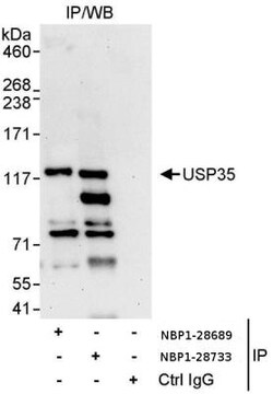 USP35 Antibody, Novus Biologicals 100 &mu;L | Buy Online | Novus Biologicals | Fisher Scientific