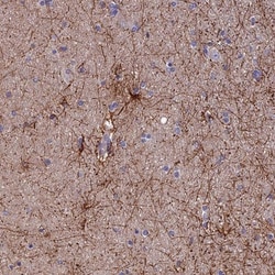 USP37 Antibody, Novus Biologicals:Antibodies:Primary Antibodies