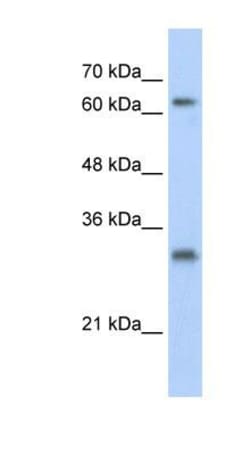 USP39 Antibody, Novus Biologicals:Antibodies:Primary Antibodies