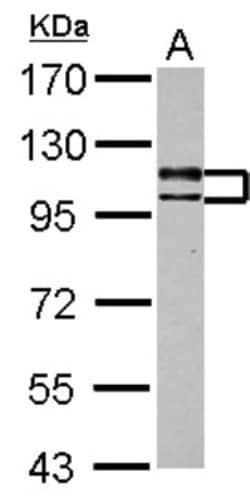 USP4 Antibody, Novus Biologicals 0.1mL; Unlabeled:Antibodies, Polyclonal