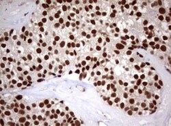 USP44 Antibody (OTI1D1), Novus Biologicals 0.1mL; Unlabeled:Antibodies,