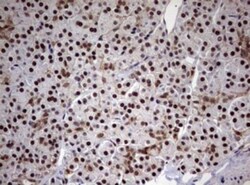 USP44 Antibody (OTI1D1), Novus Biologicals 0.1mL; Unlabeled:Antibodies,