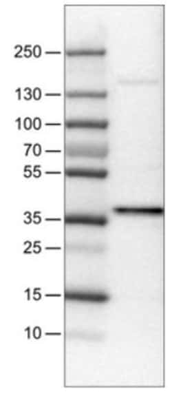USP46 Antibody (CL0364), Novus Biologicals 25ul | Buy Online | Novus Biologicals | Fisher Scientific
