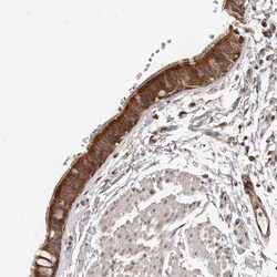 USP49 Antibody, Novus Biologicals:Antibodies:Primary Antibodies