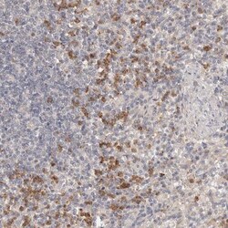 USP49 Antibody, Novus Biologicals 0.1mL; Unlabeled:Antibodies, Polyclonal