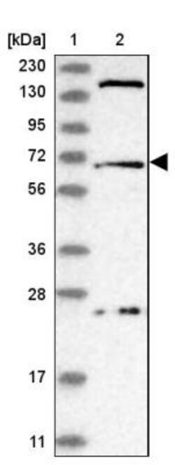 USP49 Antibody, Novus Biologicals:Antibodies:Primary Antibodies