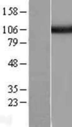 Novus Biologicals&trade;&nbsp;Isopeptidase T/USP5 Overexpression Lysate