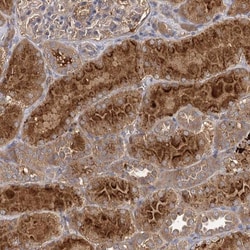 DHX58 Antibody, Novus Biologicals:Antibodies:Primary Antibodies