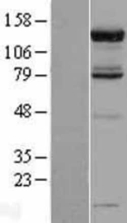 Novus Biologicals™ USP52 Overexpression Lysate
