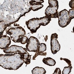 USP53 Antibody, Novus Biologicals 25 &mu;L, Unlabeled:Antibodies, Polyclonal
