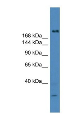 USP9Y Antibody, Novus Biologicals 20μL; Unlabeled:Antibodies, Polyclonal