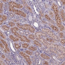USPL1 Antibody, Novus Biologicals:Antibodies:Primary Antibodies