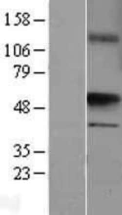 Novus Biologicals&trade;&nbsp;UST Overexpression Lysate