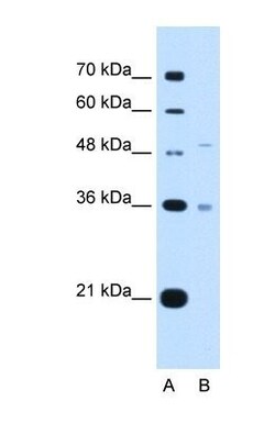 UST Antibody, Novus Biologicals 100&mu;L; Unlabeled:Antibodies, Polyclonal