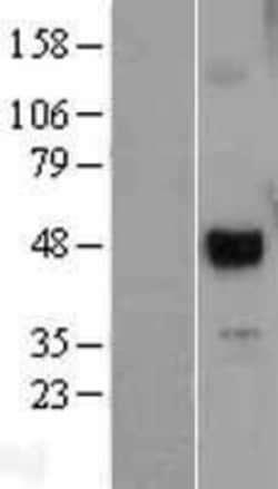 Novus Biologicals&trade;&nbsp;UTF1 Overexpression Lysate