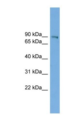 UTP14A Antibody, Novus Biologicals:Antibodies:Primary Antibodies