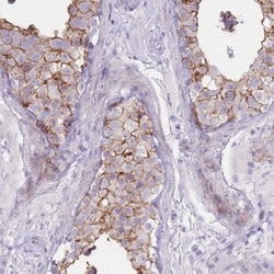 UTP14C Antibody, Novus Biologicals 0.1mL; Unlabeled:Antibodies, Polyclonal