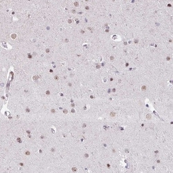 UTP18 Antibody, Novus Biologicals 0.1mL; Unlabeled:Antibodies, Polyclonal